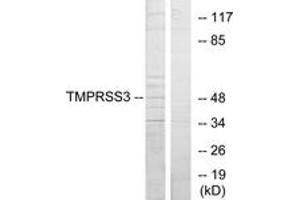 Western blot analysis of extracts from HuvEc cells, using TMPRSS3 Antibody. (TMPRSS3 抗体  (AA 405-454))