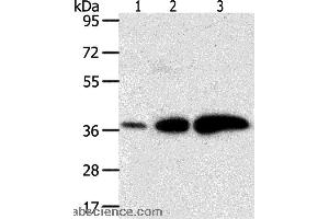 Western blot analysis of Human liver cancer and breast infiltrative duct tissue, human fetal brain tissue, using AKR1C1 Polyclonal Antibody at dilution of 1:500 (AKR1C1 抗体)