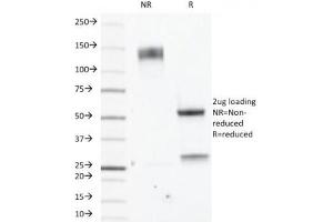 SDS-PAGE Analysis of Purified, BSA-Free Estrogen Receptor beta Antibody (clone ERb455). (ESR2 抗体  (C-Term))