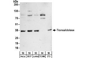 anti-Transaldolase 1 (TALDO1) (AA 200-250) antibody
