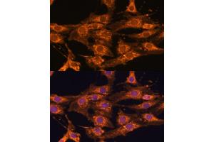 Immunofluorescence analysis of C6 cells using UBQLNL antibody (ABIN7271125) at dilution of 1:100. (UBQLNL 抗体  (AA 176-475))