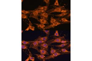 Immunofluorescence analysis of C6 cells using UBQLNL antibody (ABIN7271125) at dilution of 1:100. (UBQLNL 抗体  (AA 176-475))