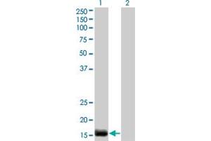 Western Blot analysis of EDN2 expression in transfected 293T cell line by EDN2 monoclonal antibody (M01), clone 3B4-1C5. (Endothelin 2 抗体  (AA 1-178))