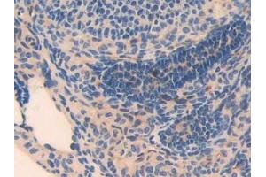 Immunohistochemistry (IHC) image for anti-Myosin, Light Chain 3 (MYL3) (AA 8-199) antibody (ABIN7443521)