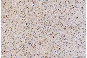 IHC analysis of LNPEP using anti-LNPEP antibody (ABIN7600279). (LNPEP 抗体  (AA 17-994))