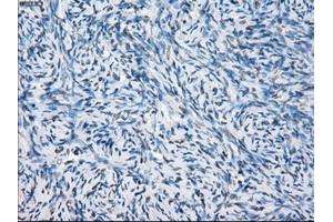 Immunohistochemical staining of paraffin-embedded colon tissue using anti-FCGR2A mouse monoclonal antibody. (FCGR2A 抗体)