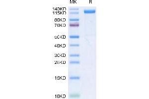 Klotho beta Protein (KLB) (His tag)