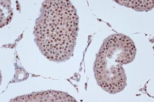 Immunohistochemistry of paraffin-embedded rat testis using KIF4A Rabbit mAb (ABIN7268134) at dilution of 1:100 (40x lens). (KIF4A 抗体)