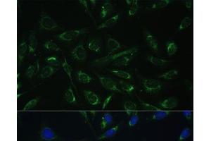 Immunofluorescence analysis of U-2 OS cells using HCCS Polyclonal Antibody at dilution of 1:100 (40x lens). (HCCS 抗体)