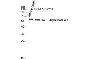 Western Blot (WB) analysis of Mouse Brain HeLa SH-SY5Y lysis using Arylsulfatase E antibody. (Arylsulfatase E 抗体  (Internal Region))