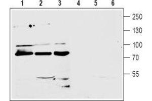 Western blot analysis of mouse (lanes 1 and 4) and rat (lanes 2 and 5) brain membranes and human CCF-STTGI astrocytoma (lanes 3 and 6) cell line lysate (1:200): - 1-3.