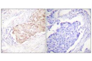Immunohistochemistry (IHC) image for anti-Ubiquitin Protein Ligase E3 Component N-Recognin 5 (UBR5) (N-Term) antibody (ABIN1848820) (UBR5 抗体  (N-Term))