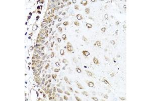 Immunohistochemistry (IHC) image for anti-Ras-Related C3 Botulinum Toxin Substrate 2 (Rho Family, Small GTP Binding Protein Rac2) (RAC2) (AA 1-192) antibody (ABIN3021524)