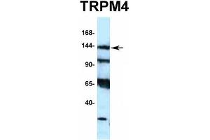 Western Blotting (WB) image for anti-Transient Receptor Potential Cation Channel, Subfamily M, Member 4 (TRPM4) (N-Term) antibody (ABIN2776221)