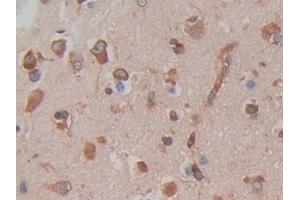 Detection of CYTH1 in Human Brain Tissue using Polyclonal Antibody to Cytohesin 1 (CYTH1) (Cytohesin 1 抗体  (AA 1-398))