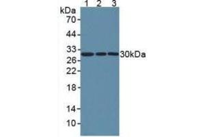 Western blot analysis of (1) Human HeLa cells, (2) Human A549 Cells and (3) Human U2OS Cells. (NNMT 抗体  (AA 1-258))