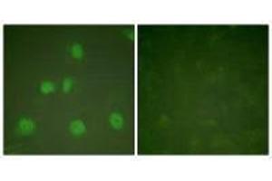 Immunofluorescence analysis of HeLa cells, treated with PMA (125 ng/mL, 30 mins), using Cullin 1 antibody. (Cullin 1 抗体)