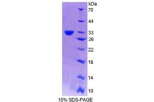 SDS-PAGE analysis of Mouse PLCd4 Protein. (PLCD4 蛋白)