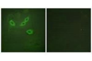 Immunofluorescence analysis of HeLa cells, using TUSC5 antibody. (TUSC5 抗体)