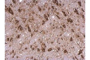 Immunohistochemistry (IHC) image for anti-Ribosomal Protein S15 (RPS15) antibody (ABIN2855194)