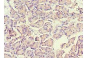 Immunohistochemistry of paraffin-embedded human pancreatic tissue using ABIN7169536 at dilution of 1:100 (ACADS 抗体  (AA 1-260))