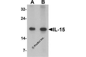 Western Blotting (WB) image for anti-Interleukin 15 (IL15) antibody (ABIN1077441)