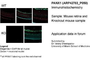 Immunohistochemistry (IHC) image for anti-Pannexin 1 (PANX1) (Middle Region) antibody (ABIN2775573) (PANX1 抗体  (Middle Region))