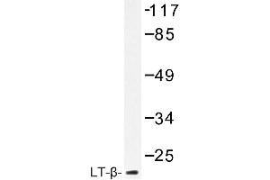 Image no. 1 for anti-Lymphotoxin-alpha (LTA) antibody (ABIN272216) (LTA 抗体)