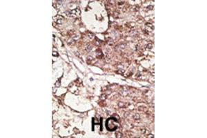 Immunohistochemistry (IHC) image for anti-CD90 (THY1) antibody (ABIN3001433) (CD90 抗体)