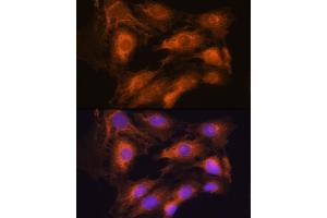 Immunofluorescence analysis of C6 cells using  Rabbit pAb (ABIN7265658) at dilution of 1:100. (ARCN1 抗体  (AA 212-511))