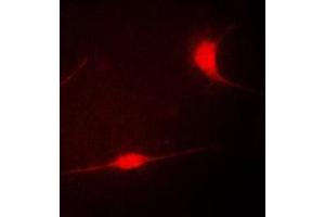 Immunofluorescent analysis of LIMK1 staining in COLO205 cells. (LIM Domain Kinase 1 抗体  (Center))