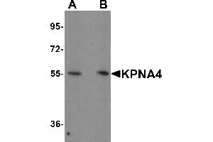 Western Blotting (WB) image for anti-Karyopherin (Importin) alpha 4 (KPNA4) (N-Term) antibody (ABIN1031431) (KPNA4 抗体  (N-Term))