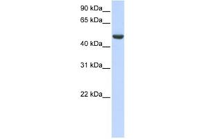 WB Suggested Anti-SPATA17 Antibody Titration: 0. (SPATA17 抗体  (C-Term))