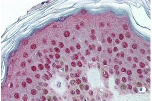 Human Skin: Formalin-Fixed, Paraffin-Embedded (FFPE)