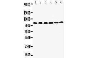 Anti-LPP antibody, Western blotting Lane 1: SMMC Cell Lysate Lane 2: HELA Cell Lysate Lane 3: SW620 Cell Lysate Lane 4: A549 Cell Lysate Lane 5: SKOV Cell Lysate Lane 6: MCF-7 Cell Lysate (LPP 抗体  (Middle Region))