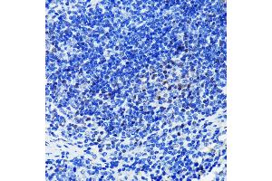 Immunohistochemistry of paraffin-embedded mouse spleen using P antibody  at dilution of 1:100 (40x lens). (PARP1 抗体)
