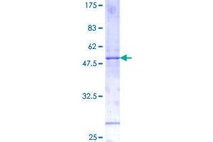 Image no. 1 for Interleukin 11 (IL11) (AA 1-199) protein (GST tag) (ABIN1307670)