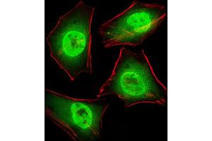 Fluorescent image of Hela cells stained with GTF2I Antibody . (GTF2I 抗体  (C-Term))