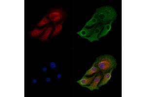 ABIN6259710 and ABIN6278976 staining Hela cells by IF/ICC. (ACAA2 抗体  (Internal Region))