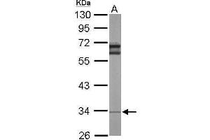 Western Blotting (WB) image for anti-Ribosomal Protein L5 (RPL5) antibody (ABIN2855187)