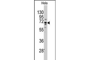 Western blot analysis of FZD1 polyclonal antibody  in HeLa cell line lysates (35 ug/lane). (FZD1 抗体  (Internal Region))