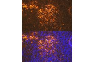 Immunofluorescence analysis of mouse spleen using CXCR5 Rabbit mAb (ABIN7266321) at dilution of 1:100 (40x lens). (CXCR5 抗体)