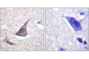 Immunohistochemistry analysis of paraffin-embedded human brain tissue, using C/EBP-epsilon (Ab-74) Antibody. (CEBPE 抗体  (AA 40-89))
