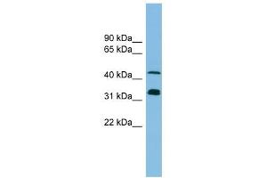 GORASP1 antibody used at 1 ug/ml to detect target protein.
