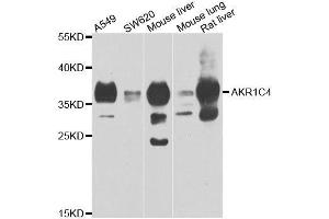 Western blot analysis of extracts of various cell lines, using AKR1C4 antibody. (AKR1C4 抗体  (AA 1-323))