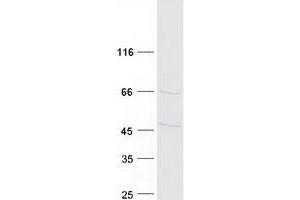 Western Blotting (WB) image for DnaJ (Hsp40) Homolog, Subfamily B, Member 12 (DNAJB12) (Transcript Variant 2) protein (Myc-DYKDDDDK Tag) (ABIN2719585)
