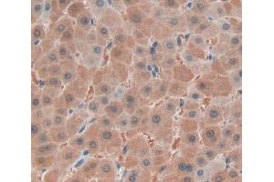 IHC-P analysis of liver tissue, with DAB staining. (FARS2 抗体  (AA 1-451))