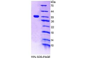 SDS-PAGE analysis of Rat PTPN22 Protein. (PTPN22 蛋白)