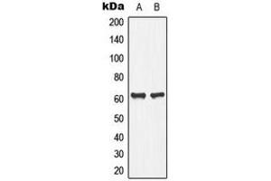 Western blot analysis of PLA2G4C expression in Jurkat (A), human pancreas (B) whole cell lysates. (PLA2G4C 抗体  (Center))
