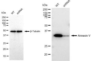 Western blotting analysis using Annexin V antibody (ABIN7797622). (Recombinant Annexin V 抗体)